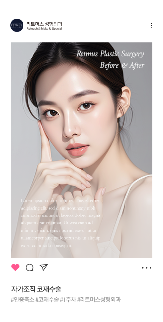 리트머스성형외과 안면윤곽 전후사진 이미지