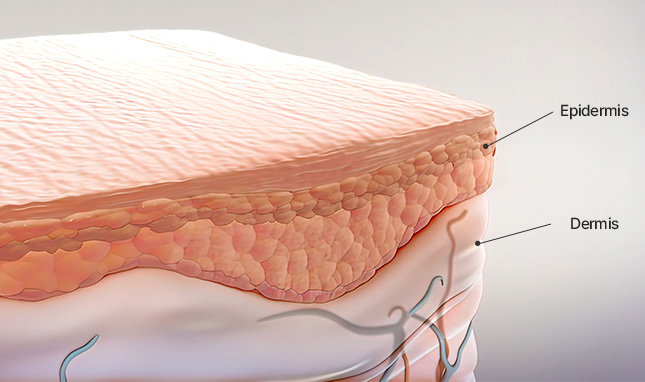 리트머스성형외과 자가조직코재수술 이미지