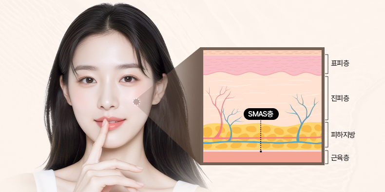 리트머스성형외과 안면거상 SMAS층 이미지