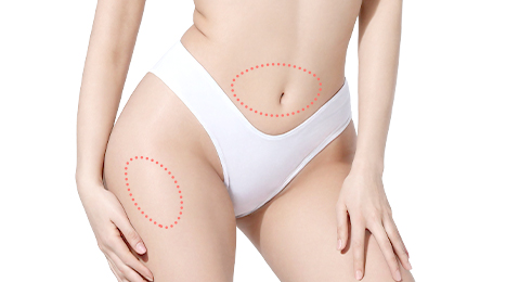 리트머스성형외과 시술방법 이미지