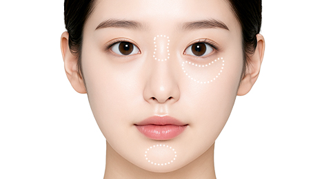 리트머스성형외과 시술방법 이미지