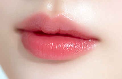 리트머스성형외과 필러 포인트 이미지