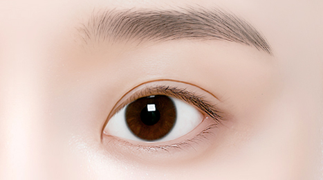 리트머스성형외과 수술방법 이미지